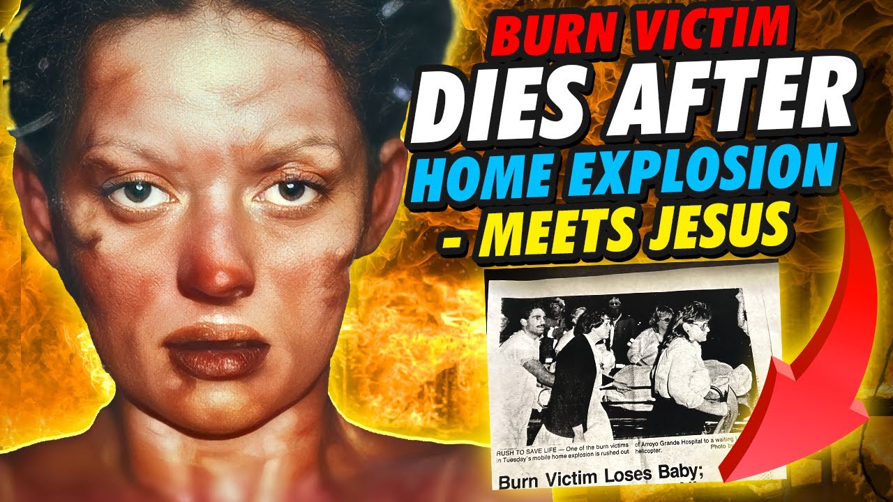 Burn Victim Dies After Home Explosion - Meets Jesus